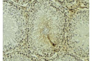ABIN6277188 at 1/100 staining Mouse testis tissue by IHC-P. (UHRF1 anticorps  (N-Term))