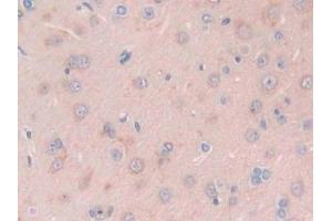 Detection of PFKP in Rat Brain Tissue using Polyclonal Antibody to Phosphofructokinase, Platelet (PFKP)