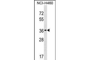 TP53TG5 Antibody (Center) (ABIN1537832 and ABIN2849793) western blot analysis in NCI- cell line lysates (35 μg/lane). (TP53TG5 anticorps  (AA 134-161))