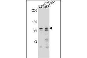 AR Antibody (Center) (ABIN656982 and ABIN2846165) western blot analysis in NCI-,NCI- cell line lysates (35 μg/lane). (Androgen Receptor anticorps  (Center))
