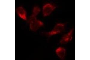 ABIN6277698 staining Hela by IF/ICC. (MSH3 anticorps  (N-Term))