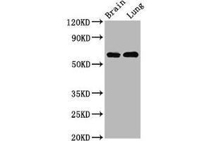 Western Blot Positive WB detected in: Rat brain tissue, Rat lung tissue All lanes: SELENON antibody at 4. (Selenoprotein N anticorps  (AA 135-219))