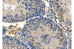 ABIN6257551 and ABIN6275682 at 1/100 staining Mouse testis tissue by IHC-P.