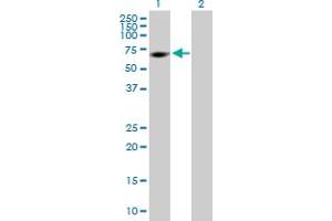 Western Blot analysis of MPP2 expression in transfected 293T cell line by MPP2 MaxPab polyclonal antibody.