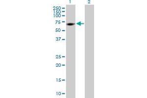 Western Blot analysis of MPP2 expression in transfected 293T cell line by MPP2 MaxPab polyclonal antibody. (MPP2 anticorps  (AA 1-552))