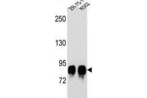 Western Blotting (WB) image for anti-Protein-O-Mannosyltransferase 1 (POMT1) antibody (ABIN2996702) (POMT1 anticorps)