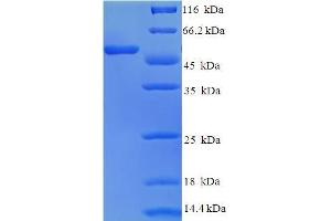 SDS-PAGE (SDS) image for Elastase, Neutrophil Expressed (ELANE) (AA 30-267) protein (GST tag) (ABIN5709463)