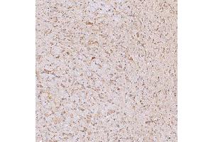 IHC analysis of SGCE using anti-SGCE antibody (ABIN7601544). (SGCE anticorps  (AA 38-407))