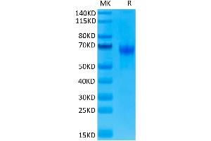 SDS-PAGE (SDS) image for Programmed Cell Death 1 (PDCD1) (AA 25-167) protein (Fc Tag) (ABIN7275419)