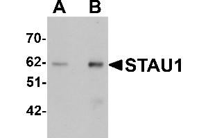 Western Blotting (WB) image for anti-Staufen Double-Stranded RNA Binding Protein 1 (STAU1) (C-Term) antibody (ABIN1030702) (STAU1/Staufen anticorps  (C-Term))