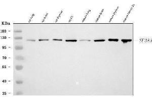 Western blot analysis of SF3A1 using anti-SF3A1 antibody (ABIN7600556). (SF3A1 anticorps  (AA 20-556))