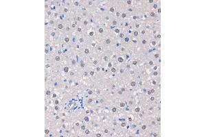 Immunohistochemistry of paraffin-embedded Rat liver using MTMR8 Rabbit pAb (ABIN7268766) at dilution of 1:100 (40x lens).