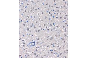Immunohistochemistry of paraffin-embedded Rat liver using MTMR8 Rabbit pAb (ABIN7268766) at dilution of 1:100 (40x lens). (MTMR8 anticorps  (AA 430-560))