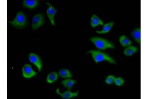 Immunofluorescence staining of A549 cells with ABIN7160322 at 1:133, counter-stained with DAPI.