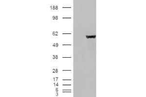 Western Blotting (WB) image for anti-Fumarate Hydratase (FH) (Internal Region) antibody (ABIN2465736) (FH anticorps  (Internal Region))