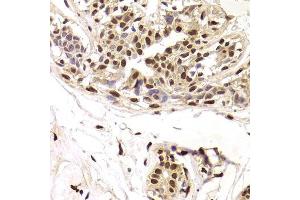 Immunohistochemistry of paraffin-embedded human breast using SNRPA Antibody. (SNRPA1 anticorps  (AA 1-282))