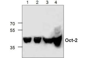 Western Blot analysis of Oct-2 expression in Lysates from Jukat cells (Lanes 1+2), 3T3 cells (Lane 3) and Rat Kidney (Lane 4). (Oct-2 anticorps  (C-Term))