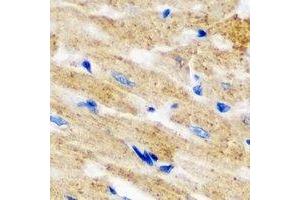 Immunohistochemical analysis of L2HGDH staining in mouse heart formalin fixed paraffin embedded tissue section. (L2HGDH anticorps)