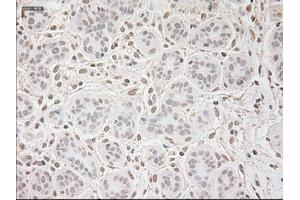 Immunohistochemical staining of paraffin-embedded breast tissue using anti-VEGF mouse monoclonal antibody. (VEGF anticorps  (AA 27-233))