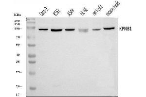 Western blot analysis of KPNB1 using anti-KPNB1 antibody (ABIN7602502).