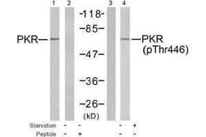 Image no. 2 for anti-Eukaryotic Translation Initiation Factor 2-alpha Kinase 2 (EIF2AK2) (pThr446) antibody (ABIN197048) (EIF2AK2 anticorps  (pThr446))