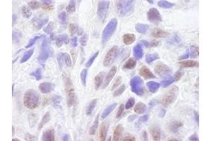 Immunohistochemistry (IHC) image for anti-CREB Binding Protein (CREBBP) (AA 2375-2425) antibody (ABIN7448459) (CBP anticorps  (AA 2375-2425))
