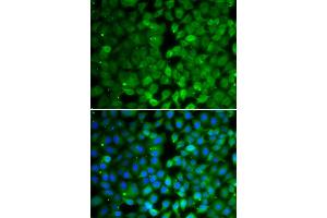 Immunofluorescence analysis of MCF-7 cells using RUNX3 antibody (ABIN4905075). (RUNX3 anticorps)