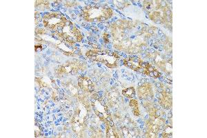 Immunohistochemistry of paraffin-embedded mouse kidney using R Rabbit mAb (ABIN7269840) at dilution of 1:100 (40x lens). (RALBP1 anticorps)