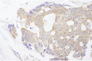 Immunohistochemistry (IHC) image for anti-Carbamoyl-Phosphate Synthetase 2, Aspartate Transcarbamylase, and Dihydroorotase (CAD) (AA 1650-1700) antibody (ABIN7448935)