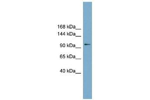 FTSJD1 antibody used at 1 ug/ml to detect target protein. (CMTR2 anticorps  (Middle Region))