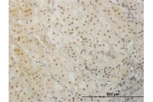 Image no. 3 for anti-LIM Homeobox 1 (LHX1) (AA 1-101) antibody (ABIN598782) (LHX1 anticorps  (AA 1-101))