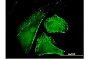 Immunofluorescence of monoclonal antibody to IQGAP1 on HeLa cell. (IQGAP1 anticorps  (AA 611-710))