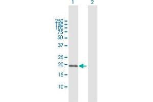 Western Blot analysis of SSH2 expression in transfected 293T cell line by SSH2 MaxPab polyclonal antibody. (SSH2 anticorps  (AA 1-178))