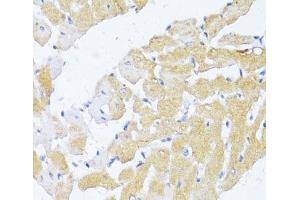 Immunohistochemistry of paraffin-embedded Rat heart using NAT2 Polyclonal Antibody at dilution of 1:100 (40x lens). (NAT2 anticorps)
