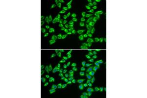 Immunofluorescence analysis of A549 cells using HADHB antibody. (HADHB anticorps)
