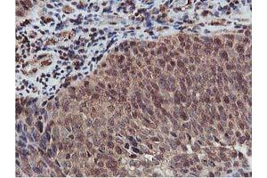 Image no. 2 for anti-V-Akt Murine Thymoma Viral Oncogene Homolog 1 (AKT1) antibody (ABIN1496556) (AKT1 anticorps)