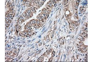 Image no. 1 for anti-Golgi Reassembly Stacking Protein 1, 65kDa (GORASP1) antibody (ABIN1498488)