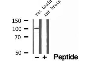 Western blot analysis of extracts of rat brain tissue, using Synaptopodin antibody.