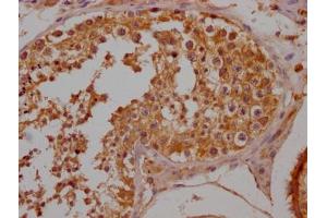 IHC image of ABIN7139953 diluted at 1:200 and staining in paraffin-embedded human testis tissue performed on a Leica BondTM system.