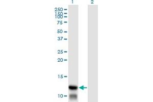 Western Blot analysis of TIMM8A expression in transfected 293T cell line by TIMM8A monoclonal antibody (M01), clone 2F11. (TIMM8A/DDP anticorps  (AA 9-97))