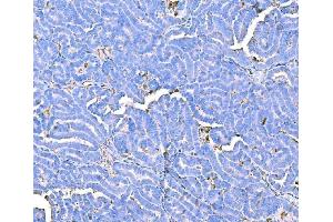 IHC analysis of Prothrombin using anti-Prothrombin antibody (ABIN7602705). (Prothrombin Fragment 2 (AA 97-124) anticorps)