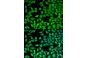 Immunofluorescence analysis of MCF-7 cells using RTKN antibody. (Rhotekin anticorps)