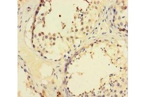 Immunohistochemistry of paraffin-embedded human testis tissue using ABIN7176122 at dilution of 1:100 (ZNF165 anticorps  (AA 1-485))