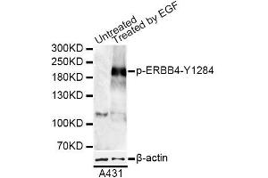 Western blot analysis of extracts of A-431 cells, using Phospho-ERBB4-Y1284 antibody (ABIN5969891) at 1/1000 dilution. (ERBB4 anticorps  (pTyr1284))