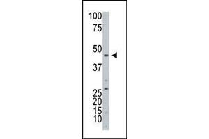 Western blot analysis of ART3 Antibody (C-term) in HL60 cell line lysates (25 μg/lane). (ART3 anticorps  (C-Term))