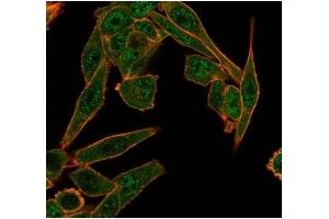 Immunofluorescence analysis of PFA-fixed HeLa cells.