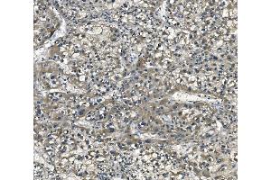 IHC analysis of eRF1/ETF1 using anti-eRF1/ETF1 antibody (ABIN7602626). (ETF1 anticorps  (AA 9-342))