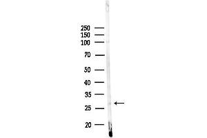 Western blot analysis of lysates from 3-L1 P6(LPS, 4h treatment), using HOX Antibody at 1/1000 dilution.