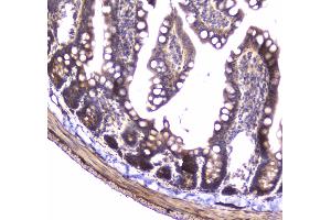IHC analysis of 14-3-3 zeta/delta using anti-14-3-3 zeta/delta antibody . (14-3-3 zeta anticorps)