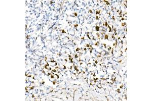 Immunohistochemistry of paraffin-embedded human tonsil using Lambda Light chain Rabbit mAb (ABIN7267847) at dilution of 1:100 (40x lens). (IGLV1-51 anticorps)